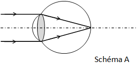 Schéma A