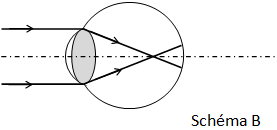 Schéma B
