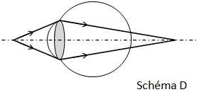Schéma D