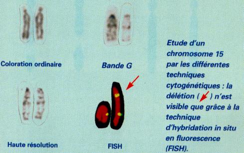 ima15fishdélétion.JPG (30771 octets)